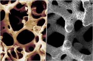 close-up of bone structure (left) vs. Trabecular Metal (right)